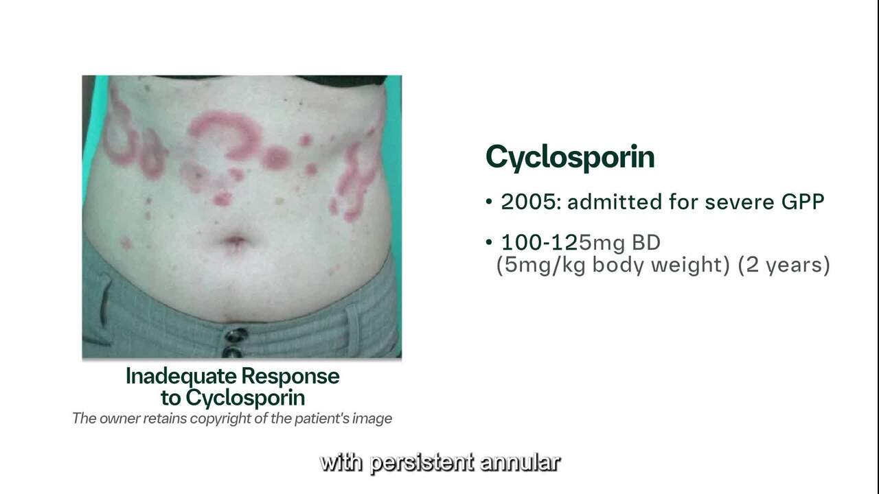 Dr Choon - GPP REELS Video #04